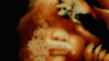 The Fabric of the Human Body